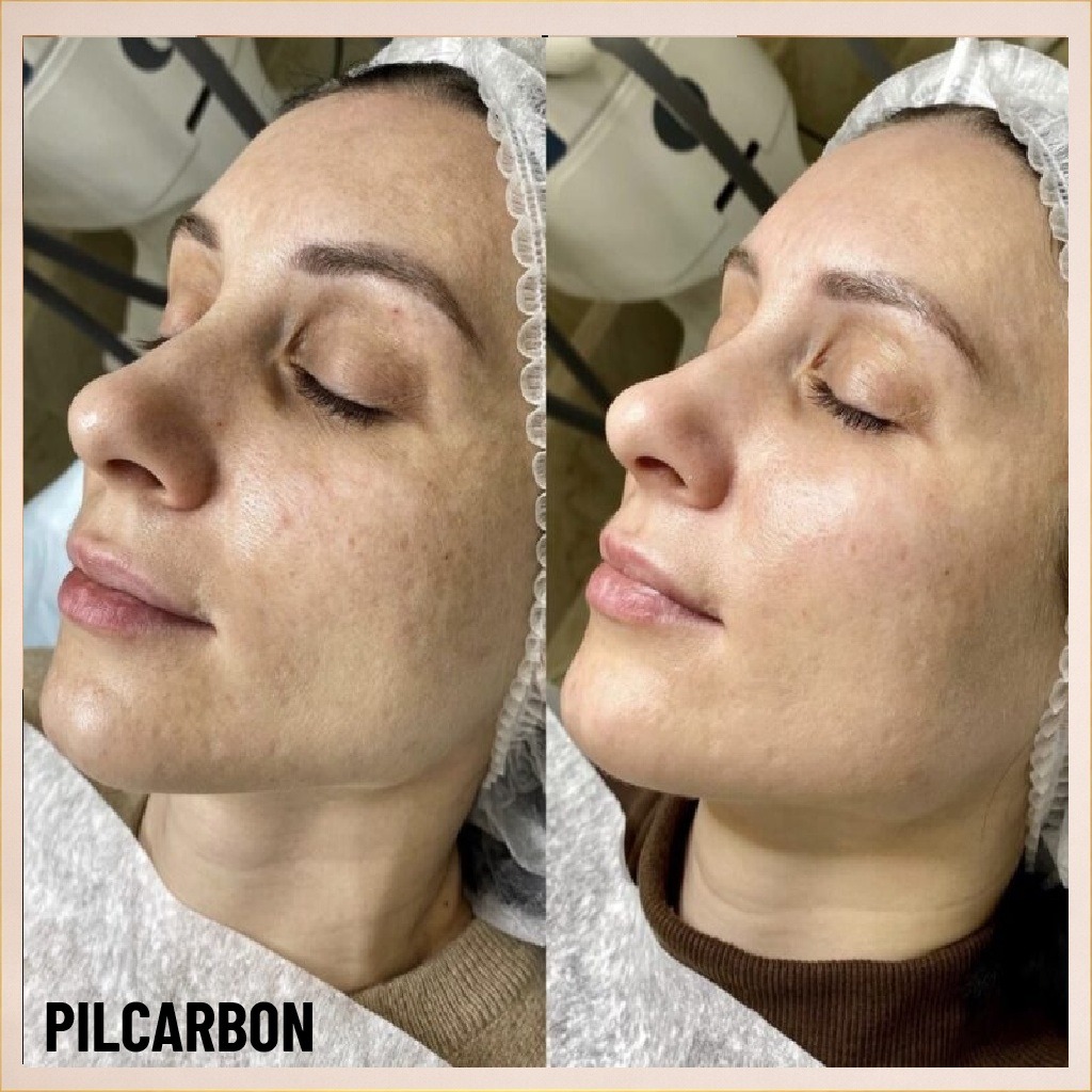 WhatsApp Image 2026-02-18 at 14.20.23 (1)